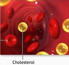 cholesterol small