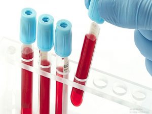 xét nghiệm sinh hóa máu